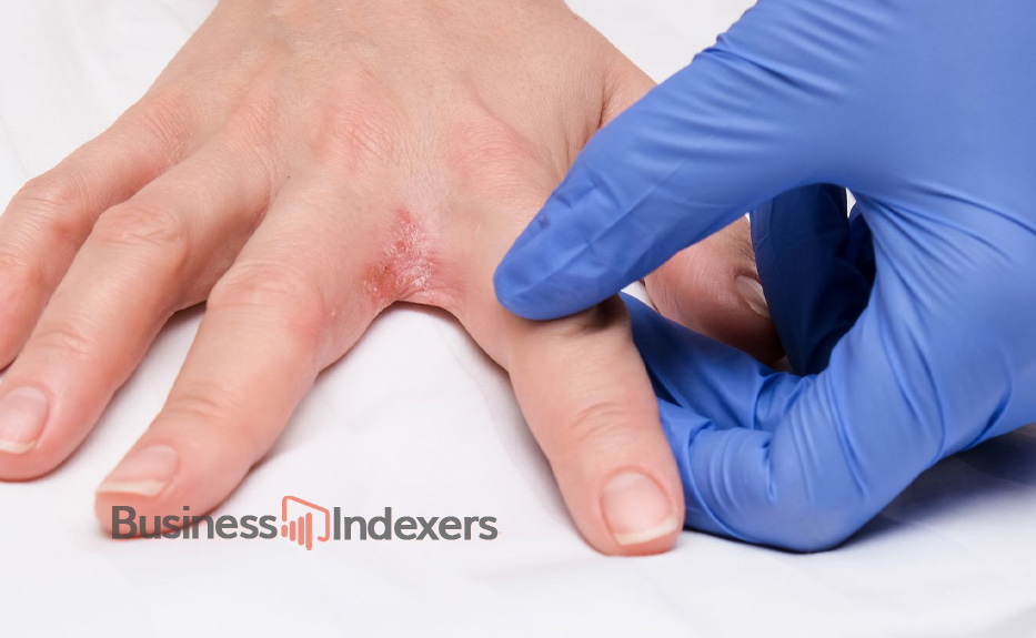 All About Blisterata: A Mysterious Natural Wonder