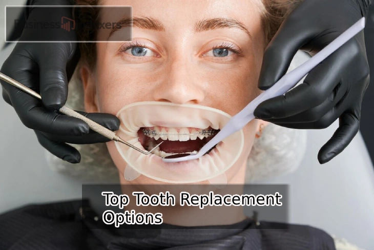 Explore the top tooth replacement options for a healthier, confident smile.